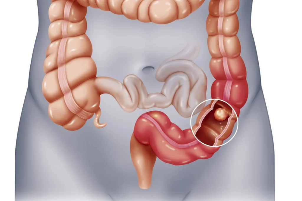 Parasiten Tabletten: Wirkung, Anwendung und Behandlung von Parasiten