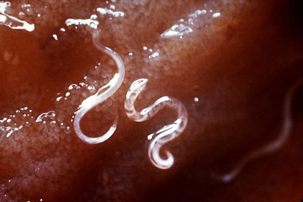 Parasiten Mittel Apotheke: Welche Präparate helfen wirklich?