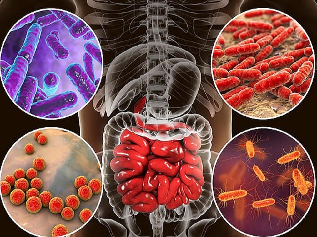 Darmparasiten Behandlung – Ursachen, Symptome und wirksame Therapien