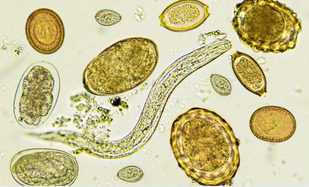Parasiten Behandlung – Ursachen erkennen und Parasiten wirksam bekämpfen