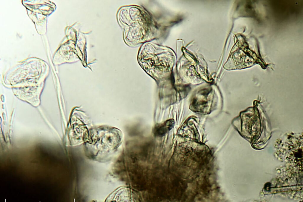 Parasitenkur: Natürliche Unterstützung für Darmbalance und Wohlbefinden