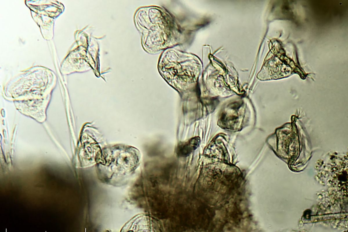 Parasitenkur: Natürliche Unterstützung für Darmbalance und Wohlbefinden