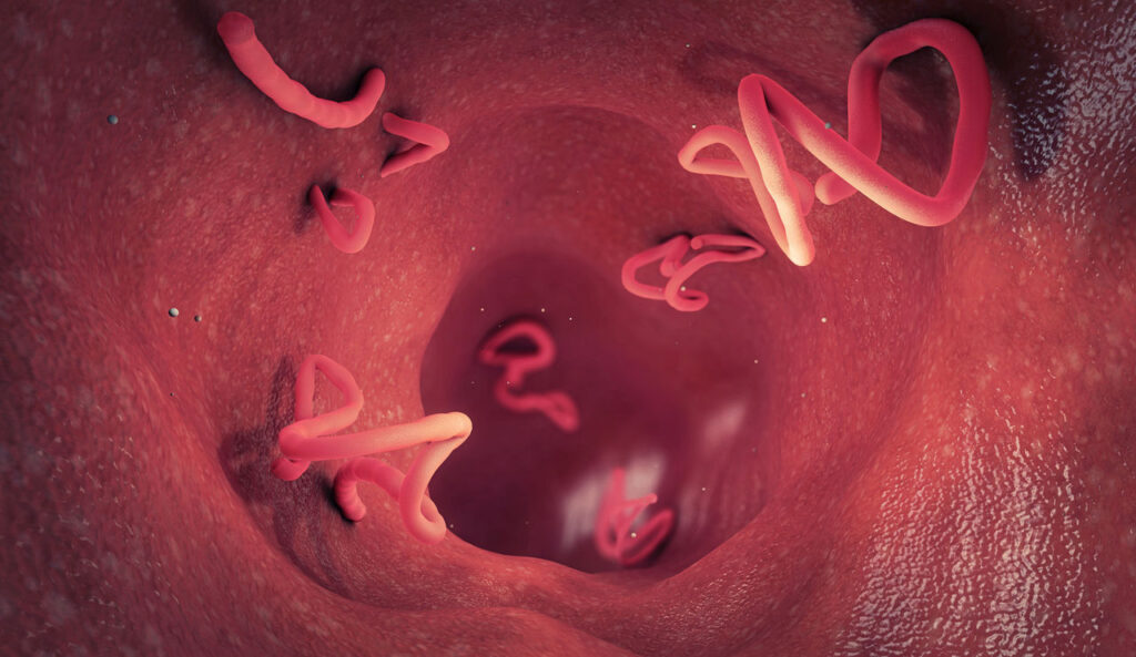 Parasiten im Körper: Symptome, Ursachen und was Sie wissen sollten