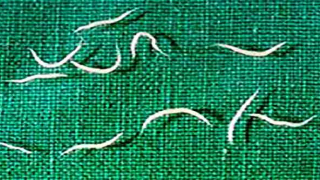 Madenwürmer: Symptome, Ansteckung, Behandlung und Vorbeugung