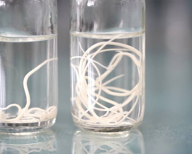 Mittel gegen Darmparasiten – Ursachen, Symptome und wirksame Behandlungsmöglichkeiten