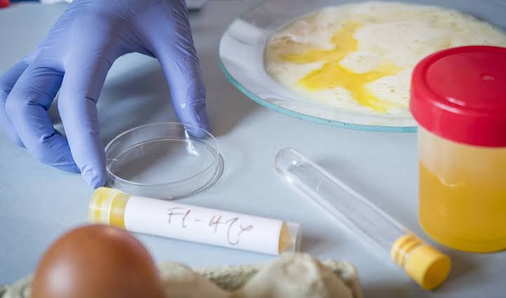 Mittel gegen Darmparasiten – Ursachen, Symptome und wirksame Behandlungsmöglichkeiten