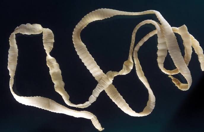 Bandwurm beim Menschen: Symptome, Ansteckung, Diagnose und Behandlung