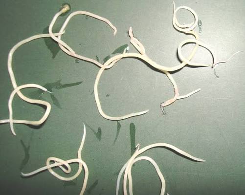 Spulwurm Behandlung: Medikamente, Therapie und wichtige Hinweise bei Askariasis