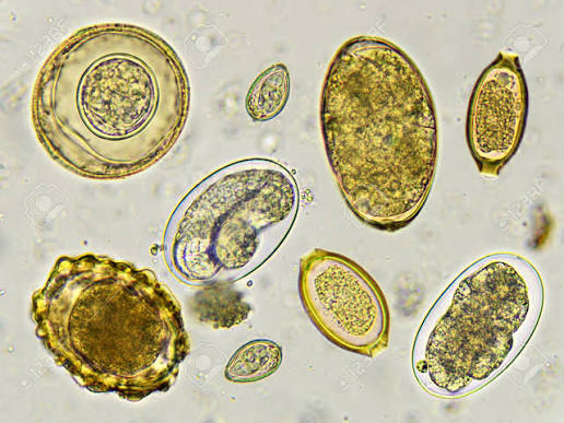 Parasiten Kapseln: Inhaltsstoffe, Anwendung und wichtige Hinweise