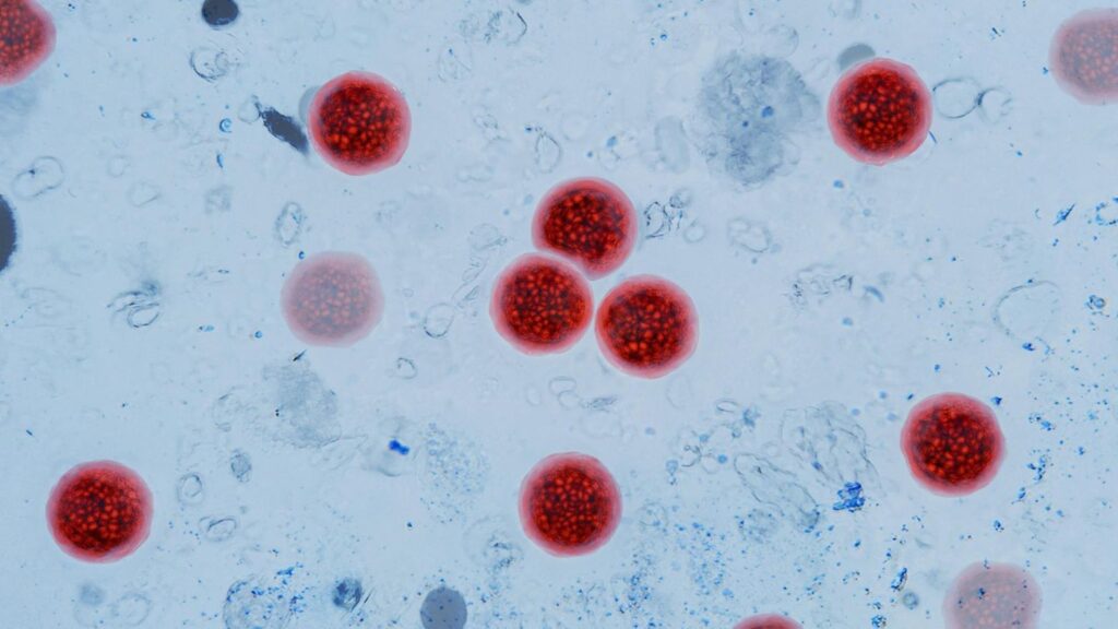 Parasiten beim Menschen: Symptome, Ursachen und was Sie wissen sollten