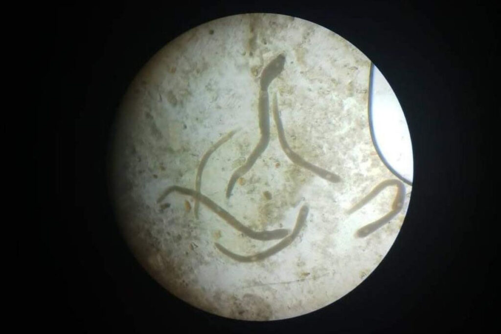 Parasiten im Stuhl: Ursachen, Symptome, Diagnose und Behandlung