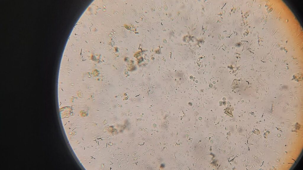 Parasiten im Stuhl: Ursachen, Symptome, Diagnose und Behandlung